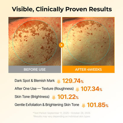 Kojic Acid Turmeric TX Toner Pads